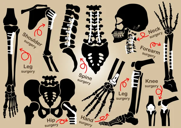 Orthopedic Surgery